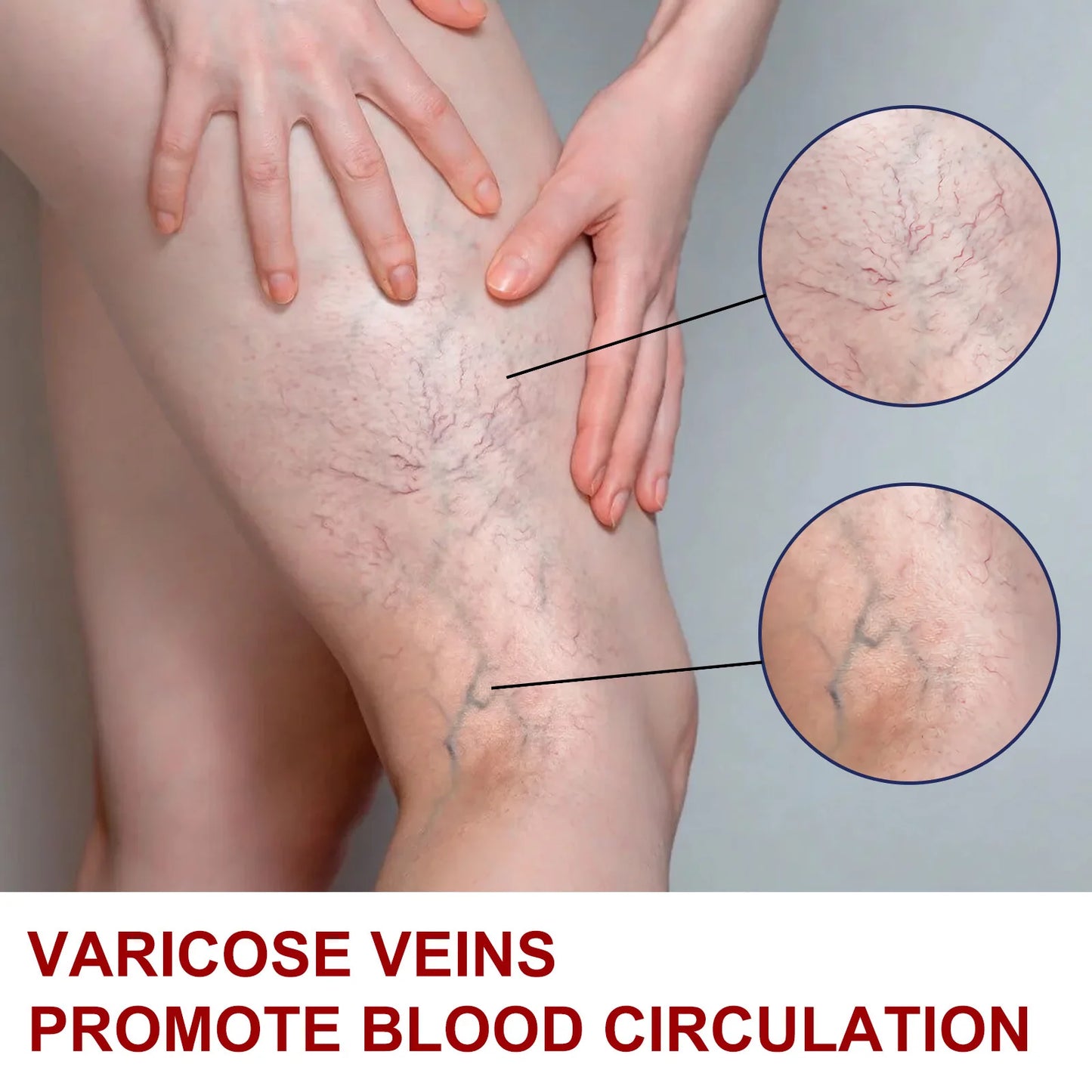 EELHOE Varicose Vein Massage Cream Relieves Leg Blood Vessel Bulging Calf Swelling Earthworm Leg Spider Inflammation Treat Cream
