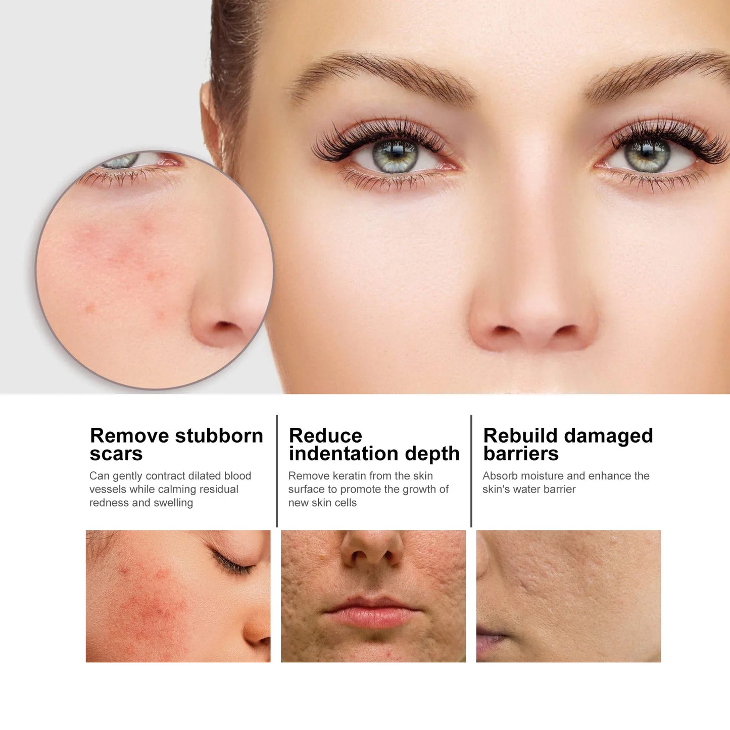 Nicotinamide Face Serum Dark Spot Whitening Acne Pimple Treatment Pore Shrinking Moisturizing Niacinamide Hyaluronic Acid Serum