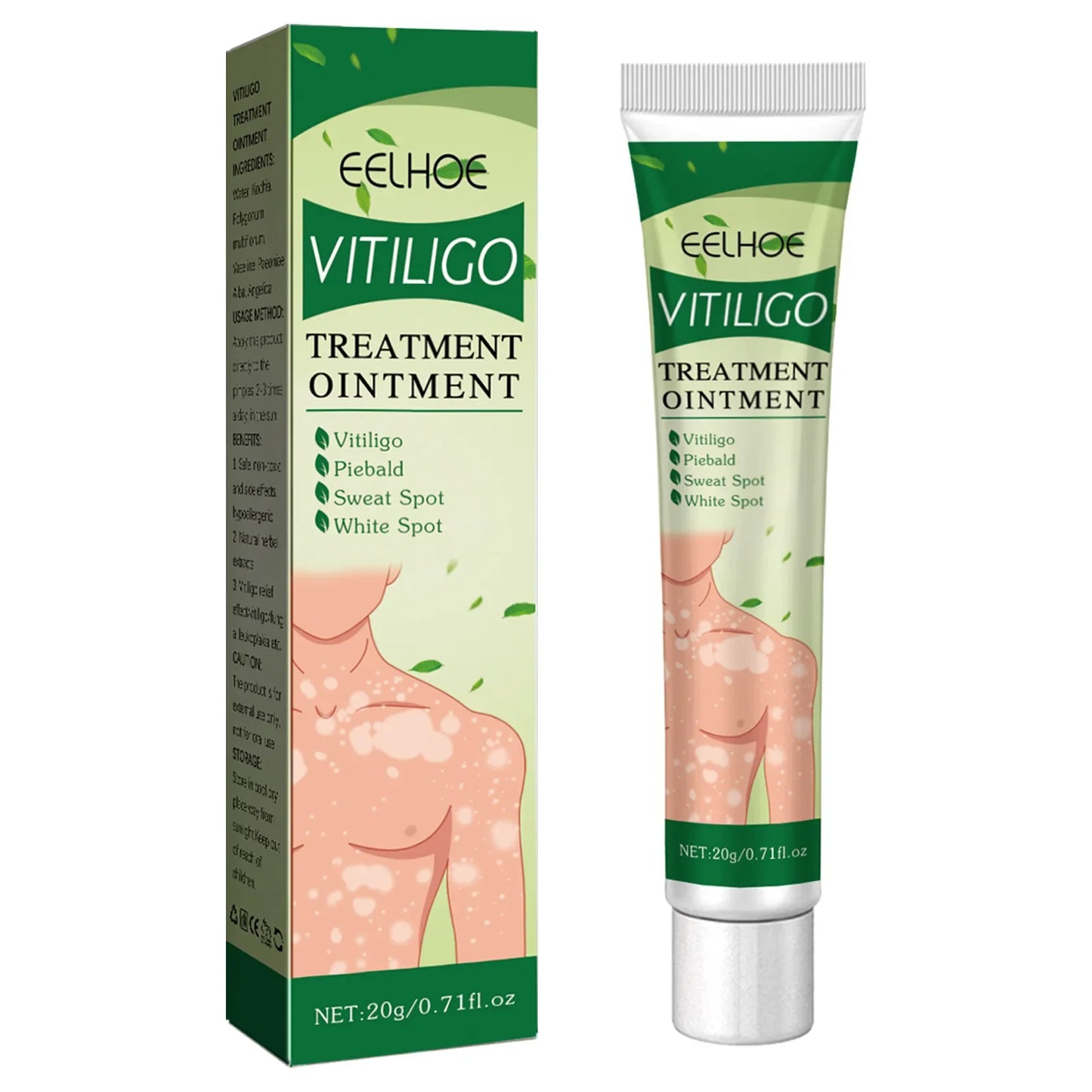 EELHOE Vitiligo Remover Ointment White Spot Disease Treatment Cream Repair Melanin Pigment Antibacterial Leukoplakia Cream 20g
