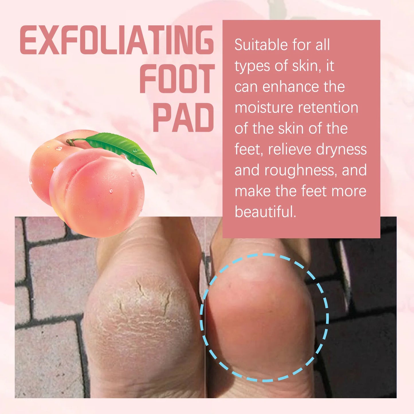Foot Peel Mask Remove Dead Skin Heel Callus Foot Peeling Exfoliation Scrub Anti Cracked Nourishing Smooth Exfoliating Foot Mask
