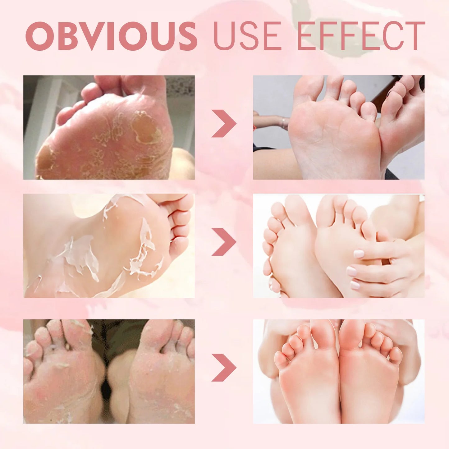 Foot Peel Mask Remove Dead Skin Heel Callus Foot Peeling Exfoliation Scrub Anti Cracked Nourishing Smooth Exfoliating Foot Mask