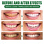 EELHOE Deep Cleaning Foam Toothpaste Mousse Teeth Whitening Products Mouth Wash Fresh Breath Dissolve Tooth Stains Oral Hygiene