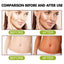 Tanning Accelerator Cream Sunless Intensive Tan Bronzer Without UV Damage After Sun Repair Outdoor Solarium Body Tanning Lotion