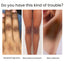 Private Parts Armpit Whitening Essence Nipple Bleach Remove Melanin Dark Knuckle Butt Knee Brighten Inner Thigh Lightening Serum