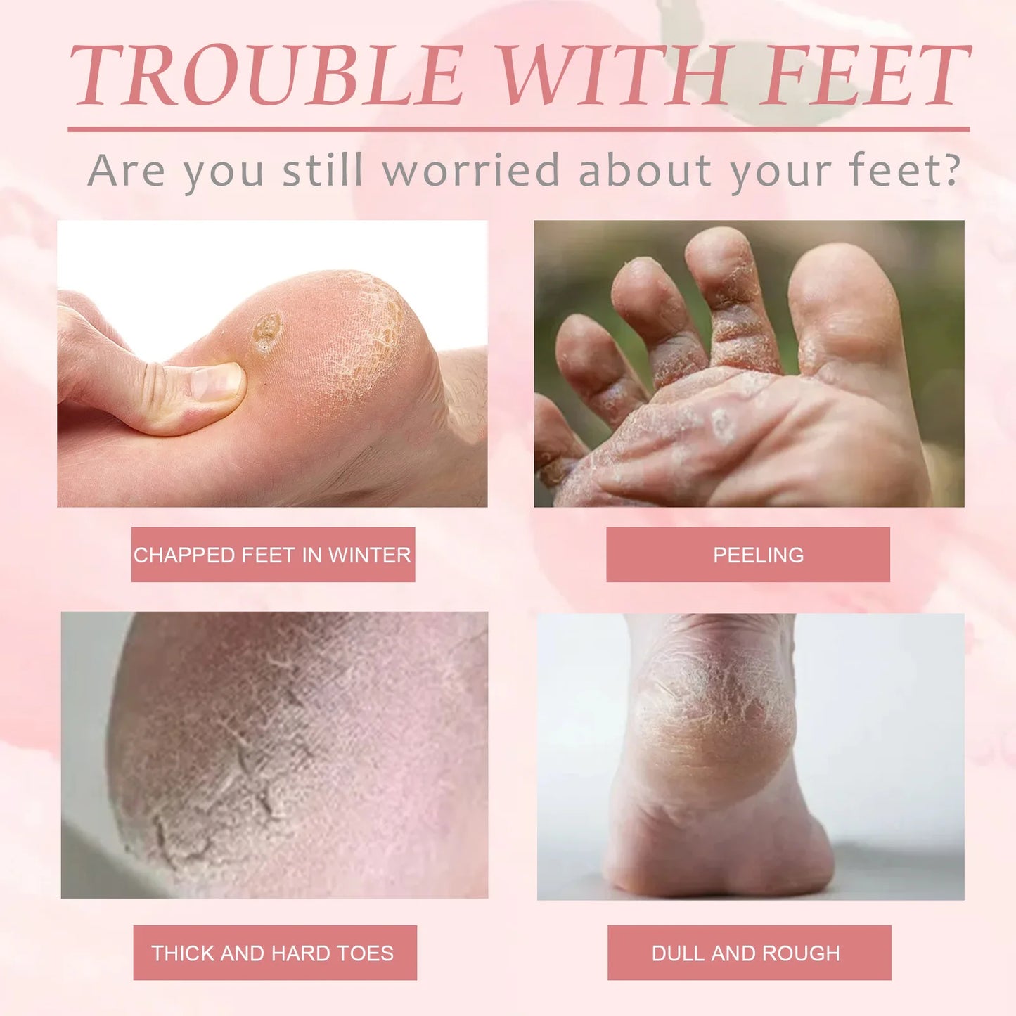 Foot Peel Mask Remove Dead Skin Heel Callus Foot Peeling Exfoliation Scrub Anti Cracked Nourishing Smooth Exfoliating Foot Mask