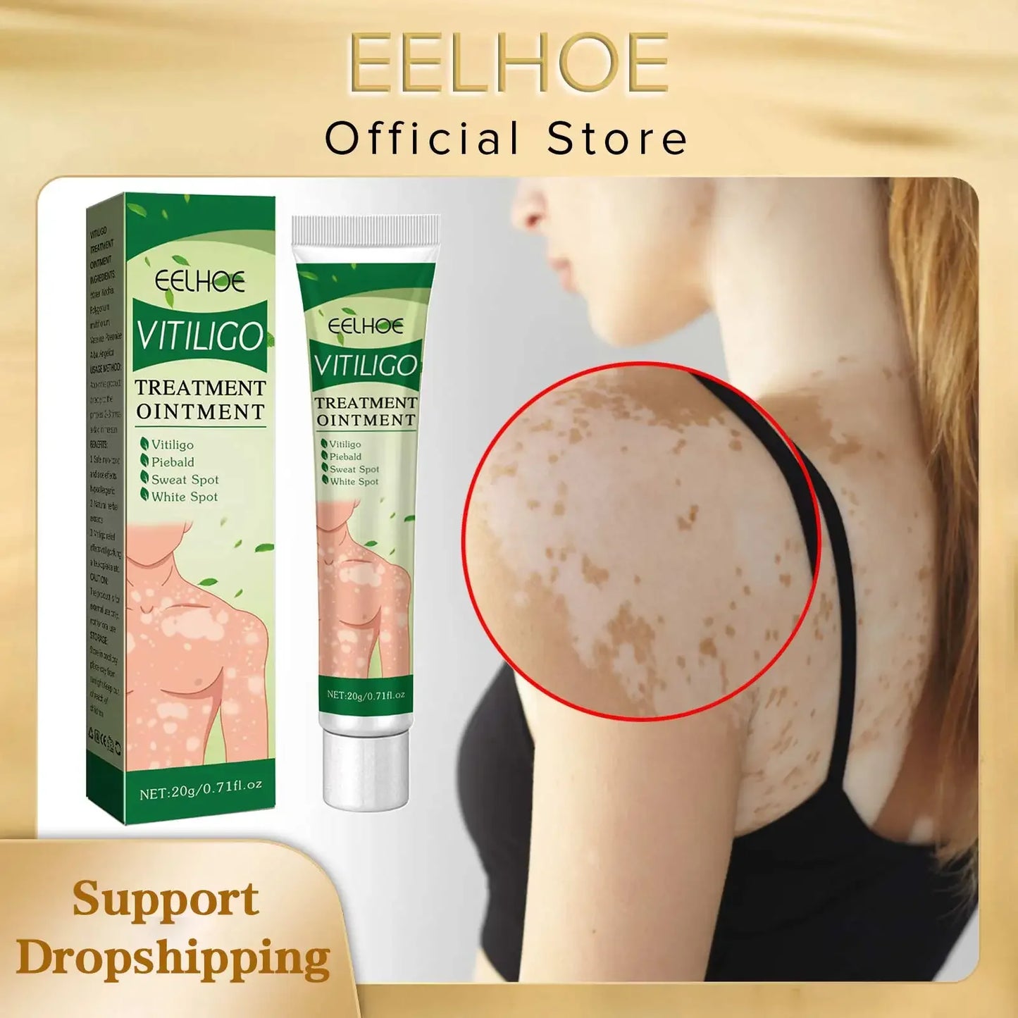 EELHOE Vitiligo Remover Ointment White Spot Disease Treatment Cream Repair Melanin Pigment Antibacterial Leukoplakia Cream 20g
