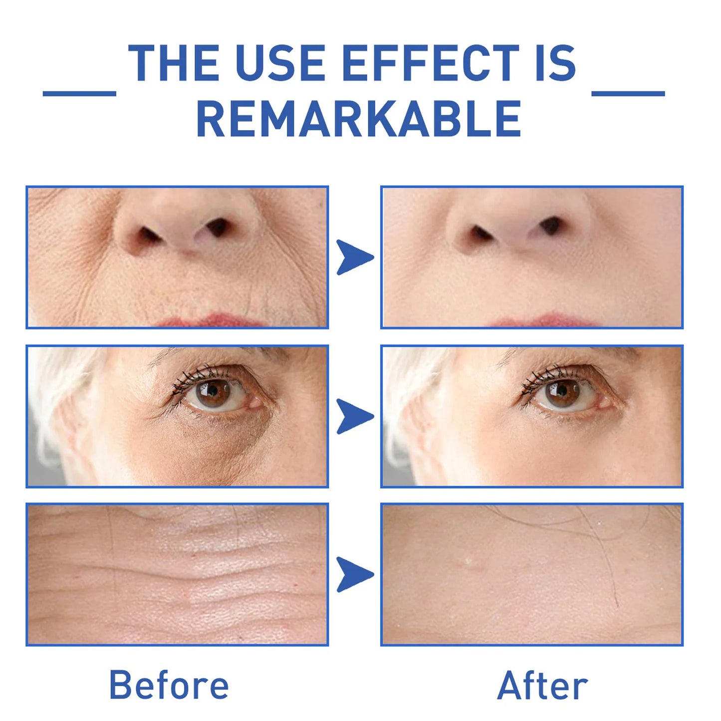 EELHOE Anti Wrinkle Essence Restore Skin Aging Sagging Collagen Improve Skin Elasticity Fade Fine Lines Wrinkle Remover Serum