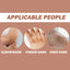 EELHOE Whitening Body Cream Remove Melanin Dark Knuckles Remover Gel Joint Elbow Private Part Underarm Bleaching Brighten Lotion