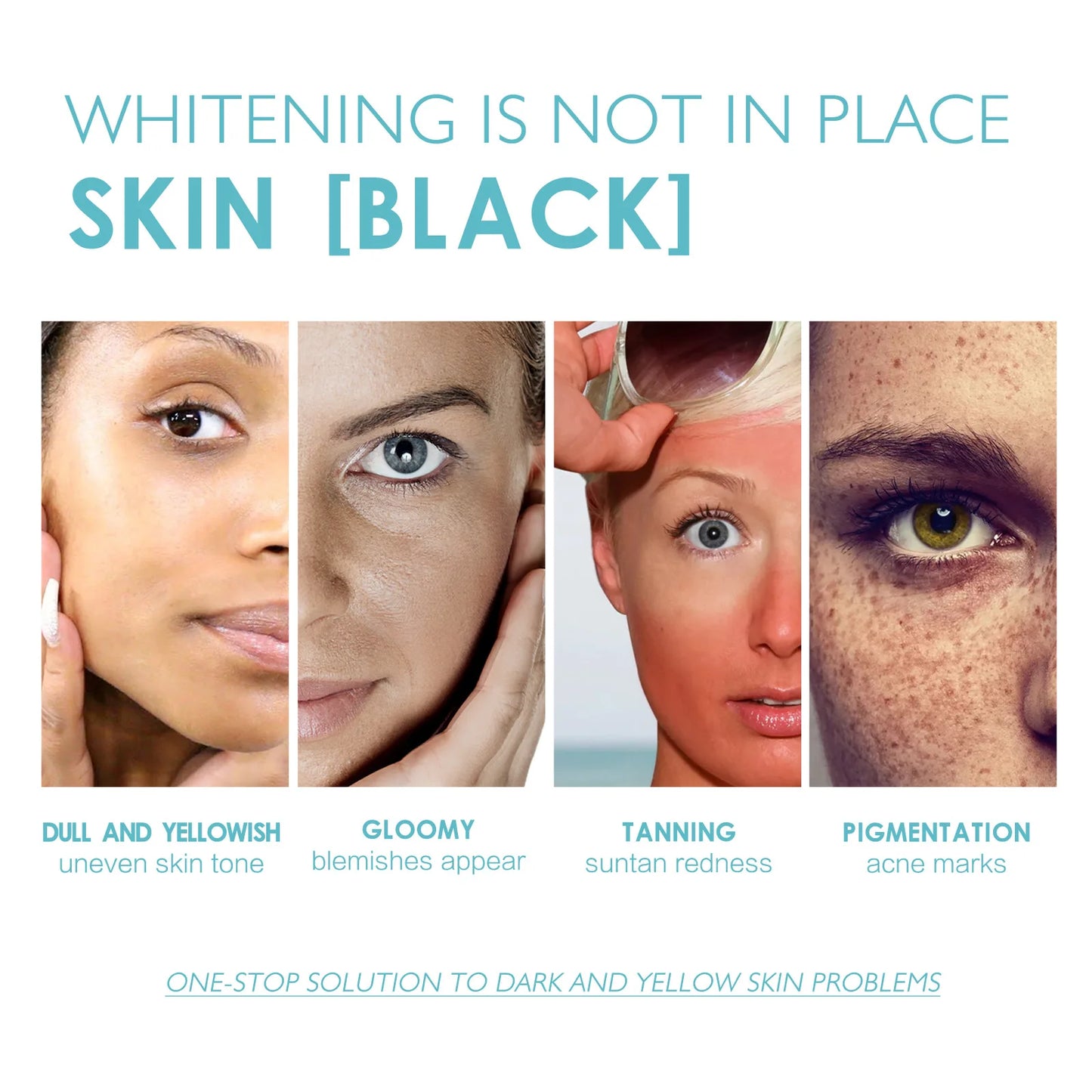 Niacinamide Facial Serum Remove Dark Spots Fade Pigmentation Melasma Chloasma Moisturizing Anti Aging Whitening Freckles Essence