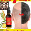 Rapid hair growth essential oil, repair baldness