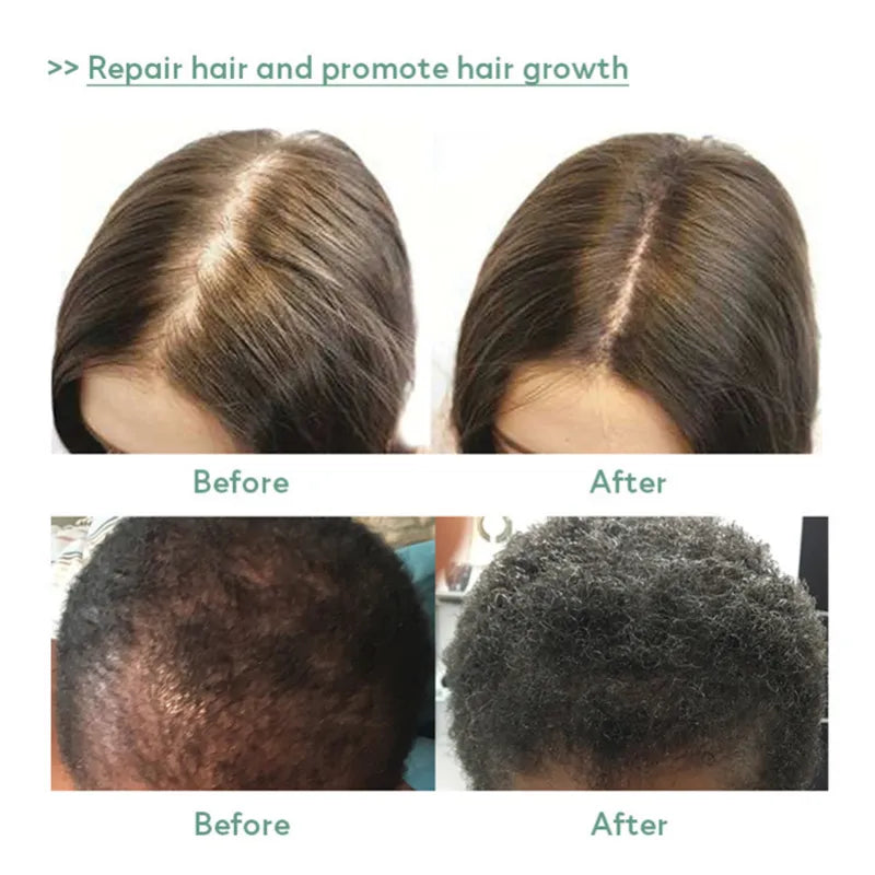 Castor Oil Hair Eyelash Brows Growth Essential Oil Prevent Skin Aging Castor Essence Moisturizer Skin Care Healthy For Women
