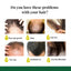 EELHOE Hair Growth Spray 7 Day Ginger Serum Scalp Damaged Treatement Prevent Hair Loss Effective Fast Growth Massage Liquid 50ml