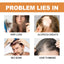 Fast Hair Regrowth Serum Prevent Hair Loss Scalp Massage Thinning Treatment Repairing Nourish Follicles Anti Hair Thinning Serum