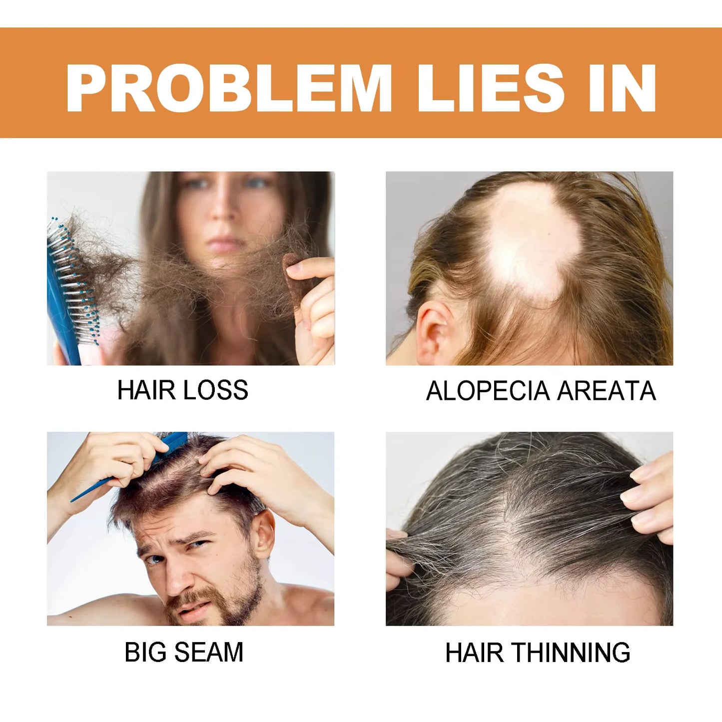 Fast Hair Regrowth Serum Prevent Hair Loss Scalp Massage Thinning Treatment Repairing Nourish Follicles Anti Hair Thinning Serum