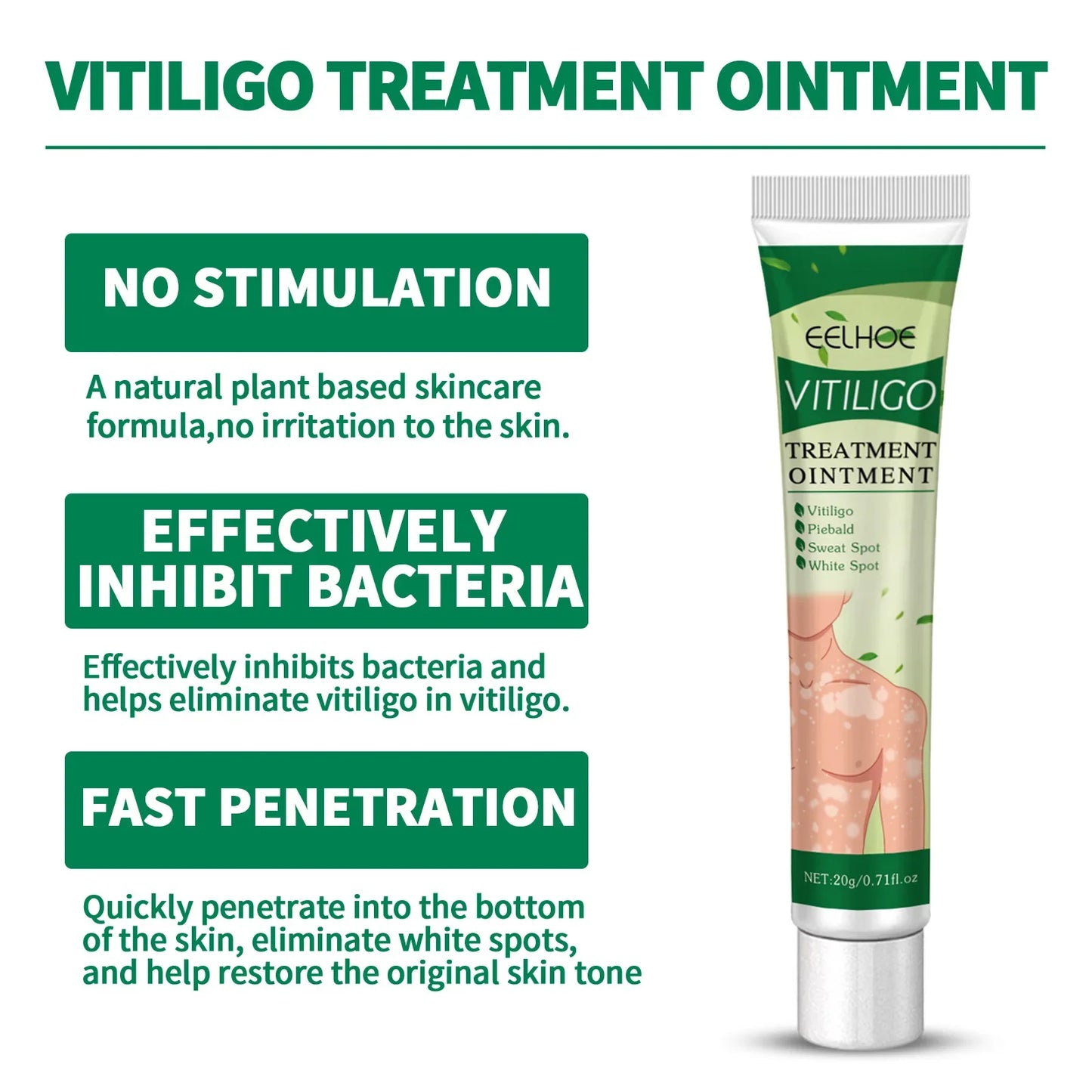 EELHOE Vitiligo Remover Ointment White Spot Disease Treatment Cream Repair Melanin Pigment Antibacterial Leukoplakia Cream 20g