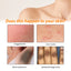 Anti Acne Body Lotion Back Butt Pimple Removal Moisturizing Whitening Joint Dark Melanin Brightening Spots Acne Treatment Lotion