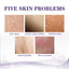 EELHOE Chicken Skin Repair Cream Curing Keratosis Pilaris Skin Treatment Body Lotion Deep Moisturizing Softening Whitening Cream