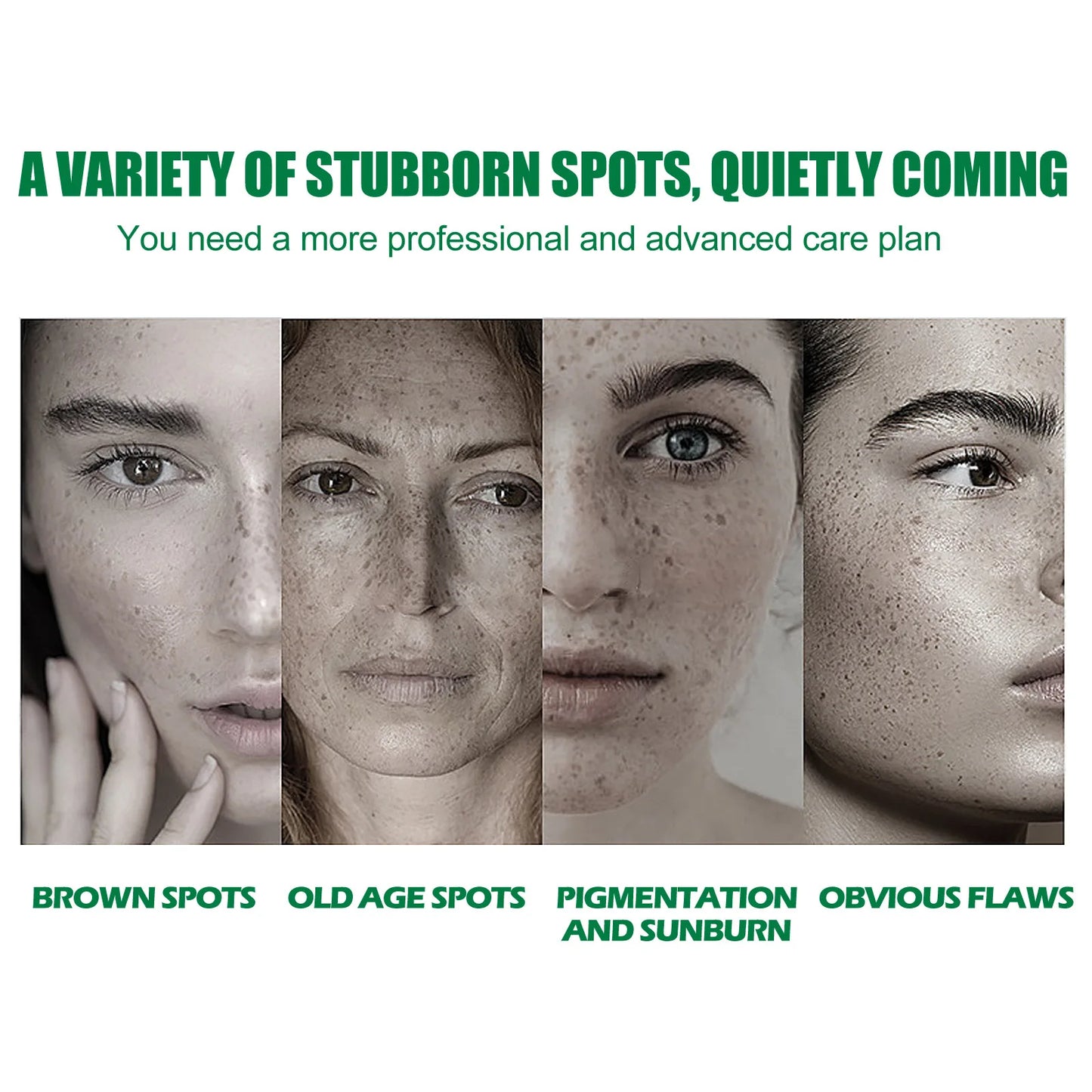 EELHOE Dark Spot Removal Serum Remove Sun Spots Melasma Remover Chloasma Moisturizing Face Repair Skin Care Anti Pigment Serum
