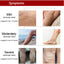 EELHOE Varicose Vein Massage Cream Relieves Leg Blood Vessel Bulging Calf Swelling Earthworm Leg Spider Inflammation Treat Cream