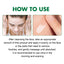EELHOE Dark Spot Removal Serum Remove Sun Spots Melasma Remover Chloasma Moisturizing Face Repair Skin Care Anti Pigment Serum