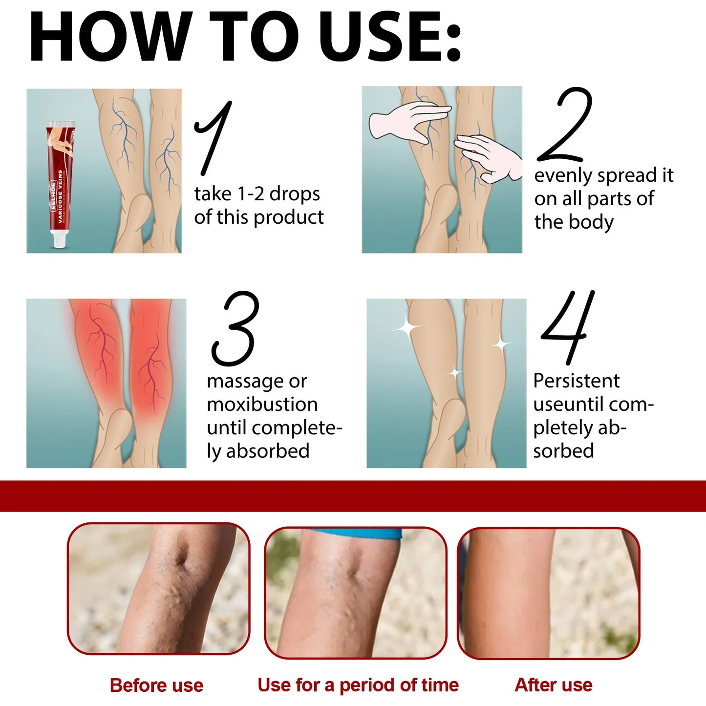 EELHOE Varicose Vein Massage Cream Relieves Leg Blood Vessel Bulging Calf Swelling Earthworm Leg Spider Inflammation Treat Cream