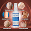 Eelhoe Varicose Veins Spray Massage Varicose Relieves Veins Earthworm Legs Spray to Relieve Leg Pain Blood Vessel Bulging Cream